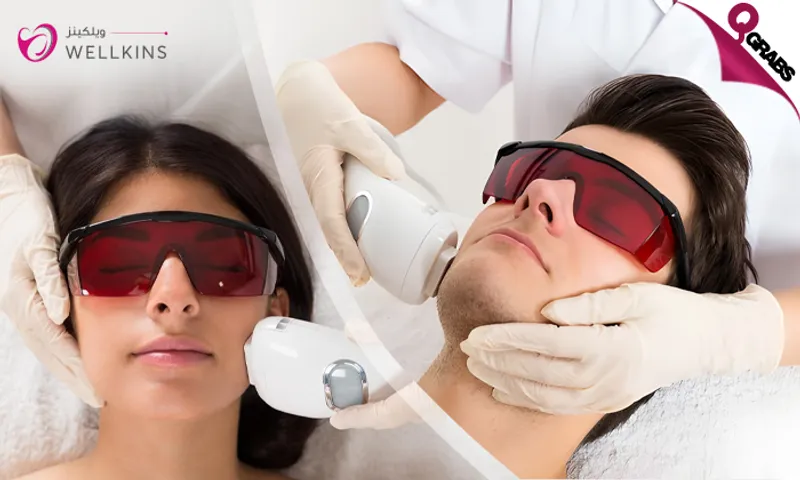 Enjoy Silky Smooth Skin with Laser Hair Removal for Ladies & Men!